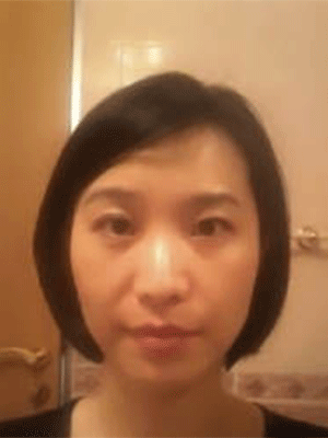 E光嫩膚 變更好的自己 - 珍美網(wǎng)