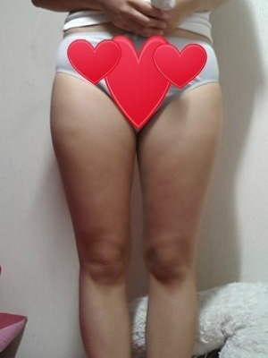 【大腿+腰部+ 屁股的吸脂整形】 性感苗條完美女人 - 珍美網(wǎng)