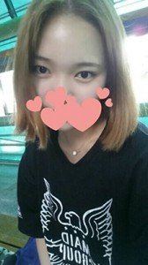 雙眼皮手術(shù) 魅力無限大