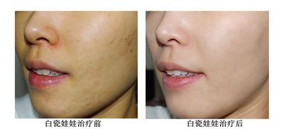 陳錦安黑臉娃娃價格多少錢 - 珍美網(wǎng)