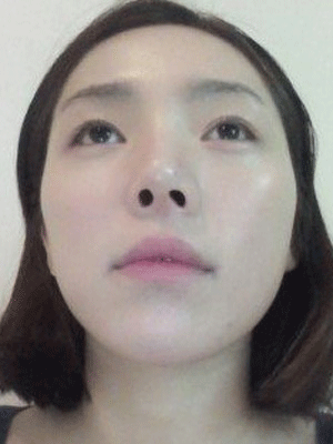 面部整形 逆襲成氣質美女 - 珍美網(wǎng)
