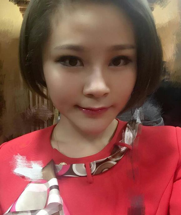 【膨體豐下巴+雙眼皮手術】對比照 成功逆襲 - 珍美網