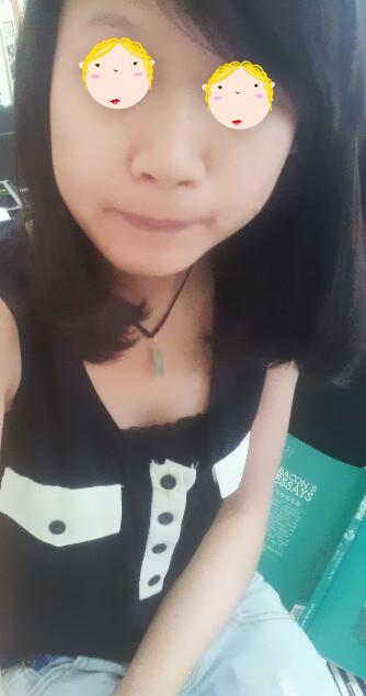 打美白針 讓自己也可以很女神 - 珍美網(wǎng)