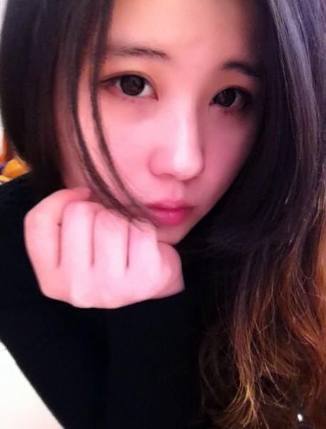 全切開內(nèi)眼角手術(shù) 讓自己越來越美麗