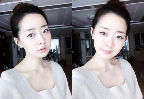 面部整形 煥然一新成為最美的自己