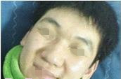 隆鼻整形 變得更加帥氣魅力的自己 - 珍美網