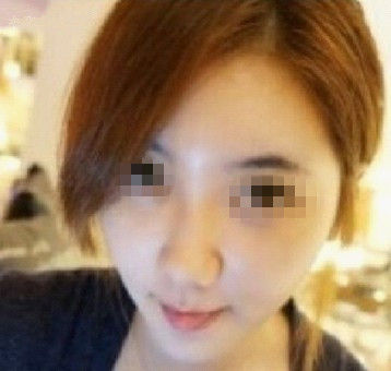面部整形 讓面部飽滿變童顏美女 - 珍美網(wǎng)
