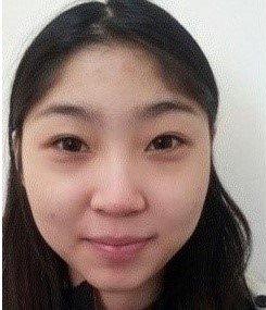 面部整形  做個(gè)精致完美的女人 - 珍美網(wǎng)