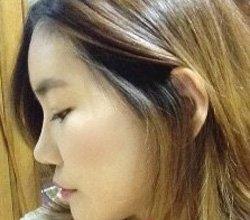 地包天矯正術(shù)  實現(xiàn)活潑美麗的自己