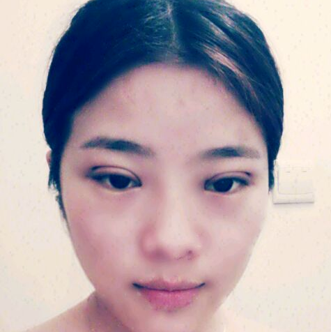 雙眼皮 實(shí)現(xiàn)不一樣美的自己 - 珍美網(wǎng)