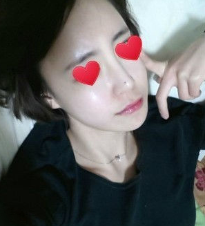 面部輪廓整形 成為萌萌的軟妹子 - 珍美網(wǎng)