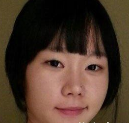 眼部整形  讓自己更加美麗動人 - 珍美網(wǎng)