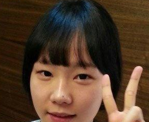 眼部整形  讓自己更加美麗動人 - 珍美網(wǎng)