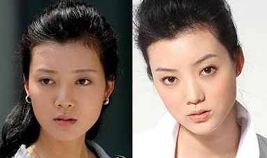 車曉被曝整容過度 鼻子外翻酷似MJ - 珍美網(wǎng)