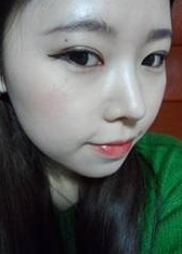 割雙眼皮+墊鼻子 越來越愛自己啦 - 珍美網(wǎng)