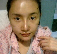 面部整形 讓我更加靚麗漂亮 - 珍美網(wǎng)