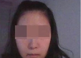 吸脂瘦臉  讓五官更加立體精致