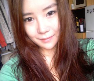 【下巴矯正+前顴骨磨骨+下顎前凸整形】感覺自己越來越美麗了 - 珍美網(wǎng)