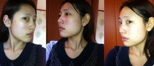 墊下巴 整體氣質(zhì)都提升了 - 珍美網(wǎng)