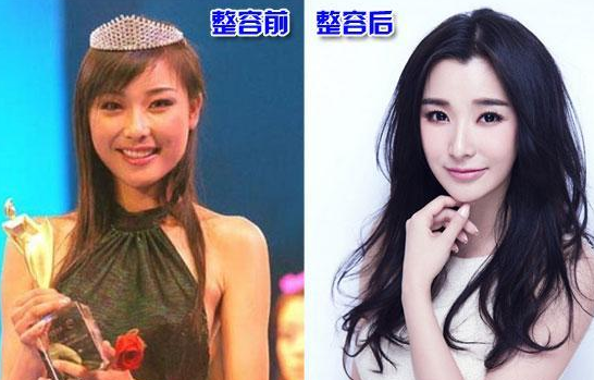 馮婧整容前后對(duì)比照片 傳是大s老公的“初戀女友”