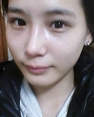 隆鼻手術(shù)  讓我更加充滿(mǎn)信心 - 珍美網(wǎng)