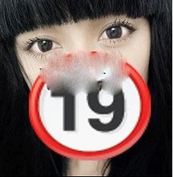 【切開法割雙眼皮+開眼角】 身邊的親人朋友都說美了
