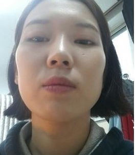 磨顴骨  才發(fā)現(xiàn)原來我可以這么美 - 珍美網(wǎng)