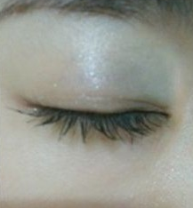 雙眼皮手術(shù) 魅力大眼睛值得擁有 - 珍美網(wǎng)