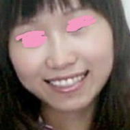 注射瘦臉針 我也可以美美噠 - 珍美網(wǎng)