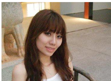 面部吸脂 比之前更加甜美漂亮啦 - 珍美網(wǎng)