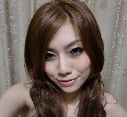 面部吸脂 比之前更加甜美漂亮啦 - 珍美網(wǎng)