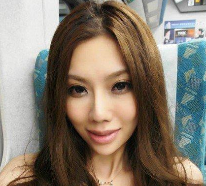 面部吸脂 比之前更加甜美漂亮啦 - 珍美網(wǎng)