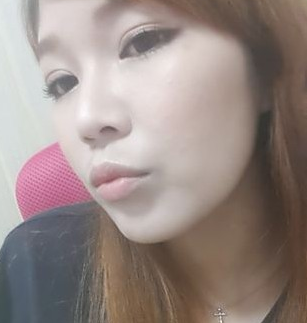 割雙眼皮手術(shù) 就可以這么漂亮 - 珍美網(wǎng)