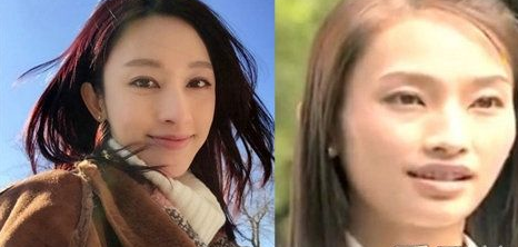 女星整容前后差距大 愿不忘初心 - 珍美網(wǎng)