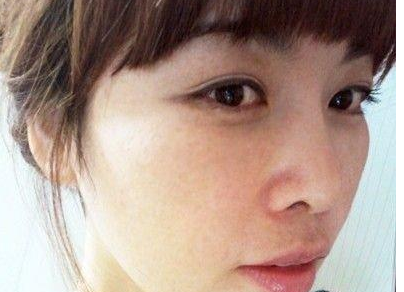 面部整形 重新找回青春的感覺 - 珍美網(wǎng)