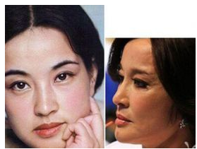 盤點那些不承認(rèn)整形的明星 她們變美了嗎  - 珍美網(wǎng)
