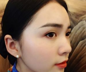 隆鼻整形  我才發(fā)現(xiàn)自己的美越來越驚艷了 - 珍美網(wǎng)