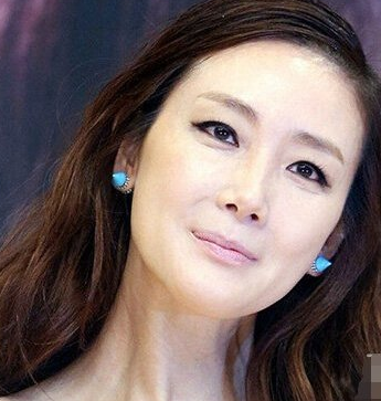 盤點下哪些女明星整容后出現(xiàn)的后遺癥 - 珍美網