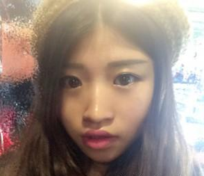 瘦臉針  讓我看起更加女人 - 珍美網(wǎng)