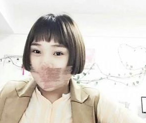 雙眼皮手術(shù) 一閃一閃的大眼睛我值得擁有 - 珍美網(wǎng)