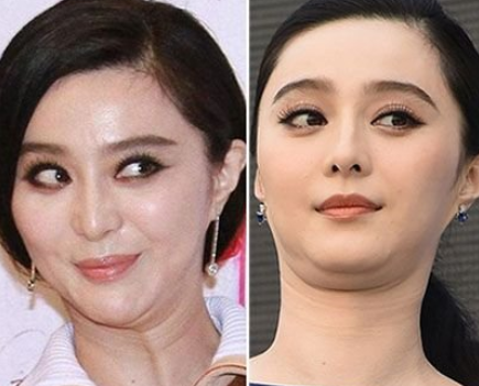 現(xiàn)雙下巴 這些女星的顏值扛不住了 - 珍美網(wǎng)