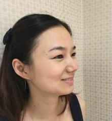 長(zhǎng)沙美研醫(yī)療美容門(mén)診部張彬醫(yī)生瘦臉案例：瘦臉針  - 珍美網(wǎng)