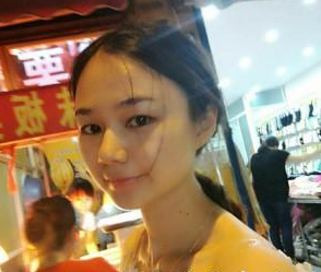 長(zhǎng)沙美研醫(yī)療美容門(mén)診部張彬醫(yī)生瘦臉案例：瘦臉針  - 珍美網(wǎng)