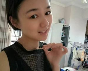 長(zhǎng)沙美研醫(yī)療美容門(mén)診部張彬醫(yī)生瘦臉案例：瘦臉針  - 珍美網(wǎng)