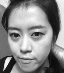 北京偉力嘉美信醫(yī)療美容門診部馬永奇醫(yī)生豐全臉案例：成就我的美 - 珍美網(wǎng)