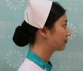 重慶星宸美容醫(yī)院彭紹宗醫(yī)生鼻部綜合整形案例：我的小翹鼻 - 珍美網(wǎng)