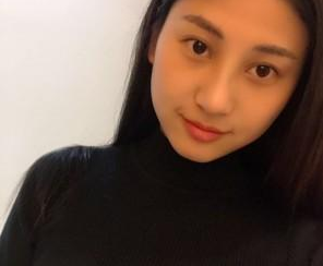 重慶星宸美容醫(yī)院彭紹宗醫(yī)生鼻部綜合整形案例：我的小翹鼻 - 珍美網(wǎng)