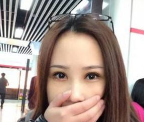 雙眼皮手術(shù) 眼睛更加迷人好看