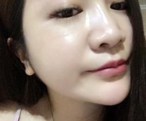 面部整形 讓我看見更美的自己 - 珍美網(wǎng)