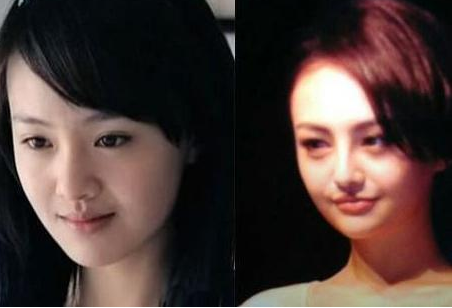 鄭爽為愛整容 但還是個(gè)很受人喜愛的女演員 - 珍美網(wǎng)